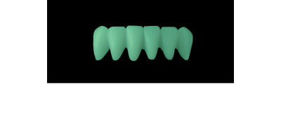Cod.C12Facing : 10x  wax facings-bridges,  SMALL, Aligned, TOOTH 43-33, compatible with Cod.A12Lingual,TOOTH 43-33 for long-term provisionals preparation